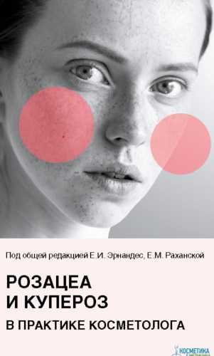Розацеа и купероз в практике косметолога